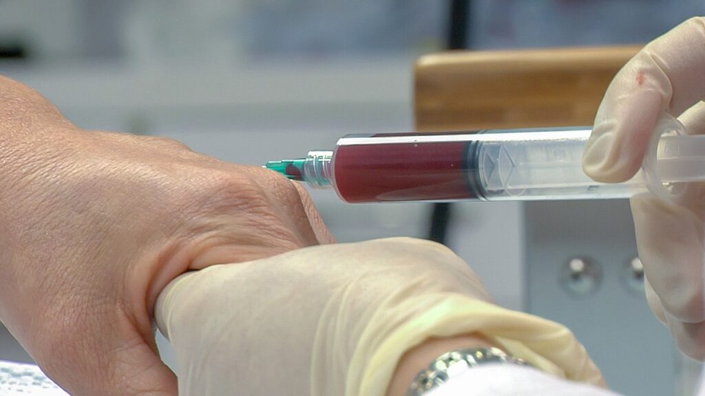 What Are PRP (Platelet Rich Plasma) Injections?