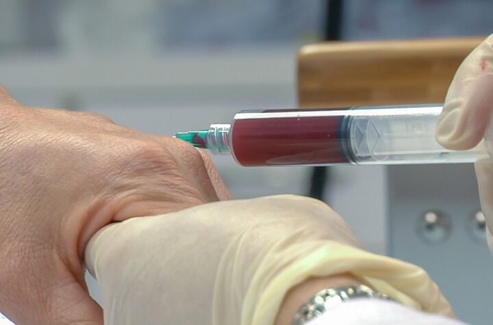 What Are PRP (Platelet Rich Plasma) Injections?